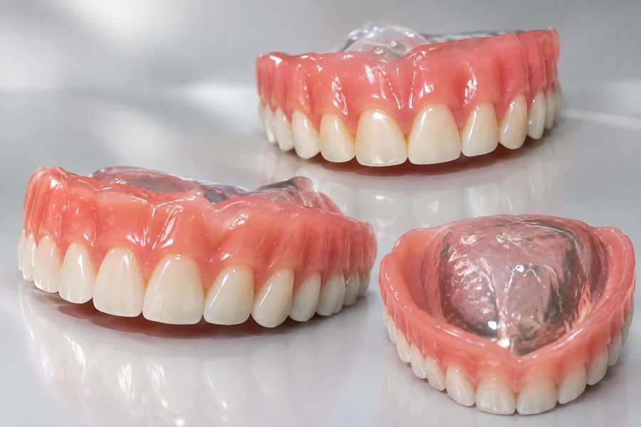 Próteses dentárias confeccionadas no Laboratório de Prótese França